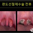 양압기 마스크 치료 문제 수면호흡장애 서울치과