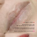 더모먼트 이미지