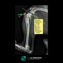정강동물병원 | 강아지 십자인대 단열 TPLO 수술 후기, 남양주 동물병원