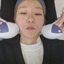 청담에너지 | 청담피부과 튠페이스리프팅 효과 솔직후기