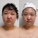 마곡 에스테틱 부종관리 전문 더나다움 후기 및 정보