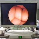 CONMED 관절경 HD 1080p Camera / LS8000 Direct LED / E9000 이미지