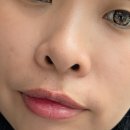 부산고우리스킨부스터주사 동래피부과 시술 효과 추천 후기
