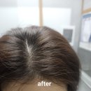 모메딕샴푸 2주 사용 후기✨ 머리 빠짐 비포&애프터 솔직 리뷰