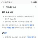 mri 결과 검토 이미지