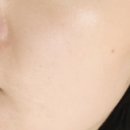 보람메디컬 이미지