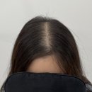 림스칼프 이미지