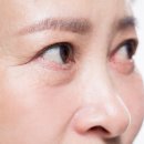 꼼꼼성형외과의원