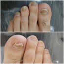 레푸스앤두두네일