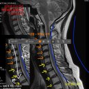 일가분식 | 2025년 11월 셋째주, 동네공구마켓 다이클로, 이천롯데아울렛 아이패딩