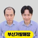 명성미용실 - 중구 서해대로483번길 33 | [부산가발매장] 티 안 나고 가벼운 사직동 미용실 맞춤가발 후기