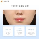 그림성형외과의원 네이버블로그