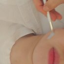 [공지] 용인 스킨 플래닝 잘하는 집 &#39;방짜하다&#39;에서 스킨 플래닝 받은 후기🤗