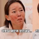 스마일피부과의원 네이버블로그