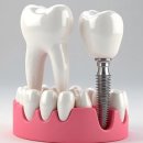 에이스플란트치과의원 이미지