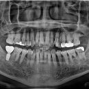 이도치과기공소 이미지
