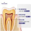 하얀미소치과 | 누런니관리 셀프 치아미백 겔 맘스폼 하얀 미소 일주일 사용해 본 후기