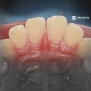 테크노파크역1-1 이미지