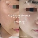 블랙헤드 물광피부 가꾸는동안 안산고잔더하이브점 솔직후기