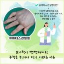 성모류마내과의원 | 무릎류마 티스관절염 이유 없는 통증이 지속된다면