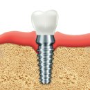 강북다인치과의원 이미지