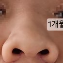 서면Q 외과 동물병원 | 성형 | 콧볼축소 한달 내돈내산 후기 서면 @@@@ 성형 외과
