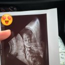 태전포도나무산부인과의원 | 태전포도나무산부인과 _ 경기 광주 태전동 산부인과 추천