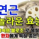 연근 효능 연근조림 칼로리 연근 영양성분 이미지