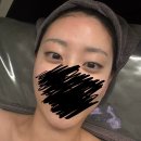 고은세탁 | 결이고은 광명점, 피부관리 받은 후기