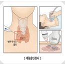 이영미유외과의원 | 미사 유미즈외과 갑상선 세침흡인검사 후기