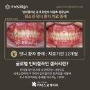 글로벌아너스