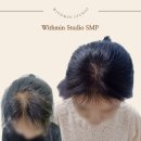 부산 범일동 가르마두피문신 / SMP 잘하는 곳 , 위드민 스튜디오