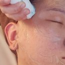 에스테틱선 - 군산시 남수송5길 49-3 | 군산 윤곽관리 에스테틱선 성형 윤곽관리 B코스 후기