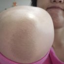 겨드랑이 색소침착 나이데카 착색크림 3주후기 솔직후기