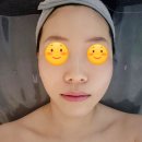 벨라 에스테틱 | 주안 피부샵 뉴벨라에스테틱에서 받은 피부관리 솔직 후기