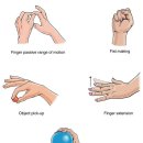 Mallet Finger (Baseball Finger) Rehabilitation Exercises 이미지