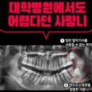 강남 사랑니 발치 잘하는 치과라면 이 정도는?