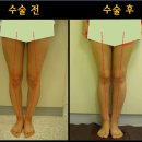 후메디앙스 이미지