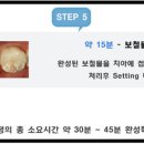 유니크치과기공소 이미지