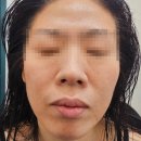 Ann(앤)헤어&스킨바디클리닉 | 두피와 피부 관리를 한번에 가능한 뷰스킨앤숲칼프 김포장기점 방문 후기
