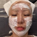부산 서면 트리니티 리프팅 내돈내산 리얼후기