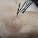 동빈한의원 이미지