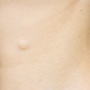 눈꽃피부과의원 이미지