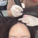 [송도 두피케어 추천] 스튜디오 참 후기, 엑소좀 관리로 힐링하고 왔어요!