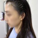 촘촘 스칼프 이미지