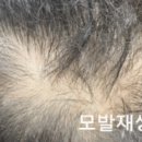 더블라인