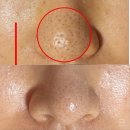 🎉 여름철 모공관리 7월 파메위크 스페셜 혜택 총정리! 피부 타입별 맞춤 케어 + 선착순 파메콘 키링까지 🎁
