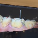 크라운치과기공소 이미지