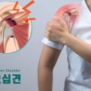 송파원정형외과의원 네이버블로그