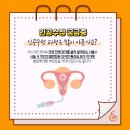 수정A 이미지